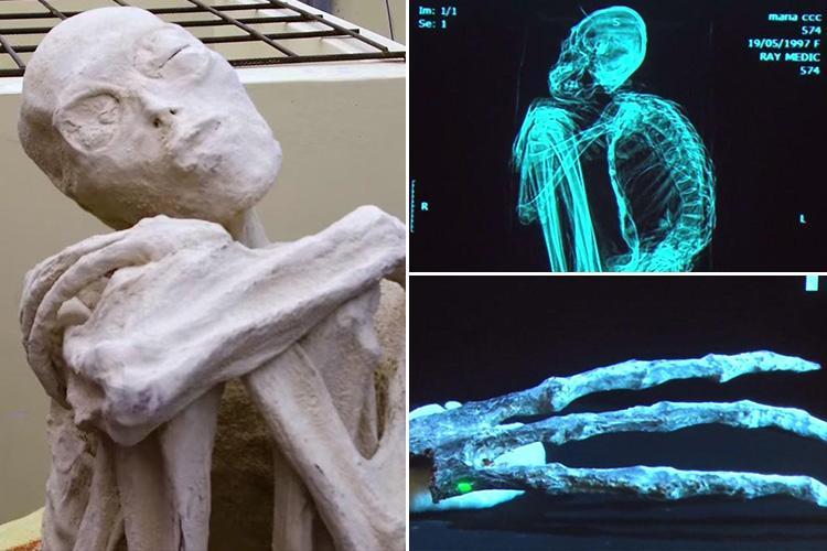 Alien Mummies From Peru Have Human Chromosome Numbers, But Not Anatomy