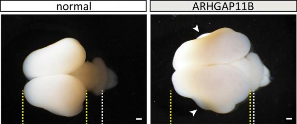 Wildtype (normal) and ARHGAP11B-transgenic fetal (101 days) marmoset brains. Yellow lines, boundaries of cerebral cortex; white lines, developing cerebellum; arrowheads, folds. Scale bars, 1 mm. (Heide et al. / MPI-CBG)