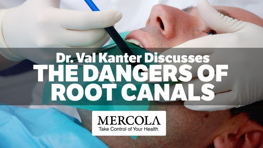 dangers of root canals mercola val kanter