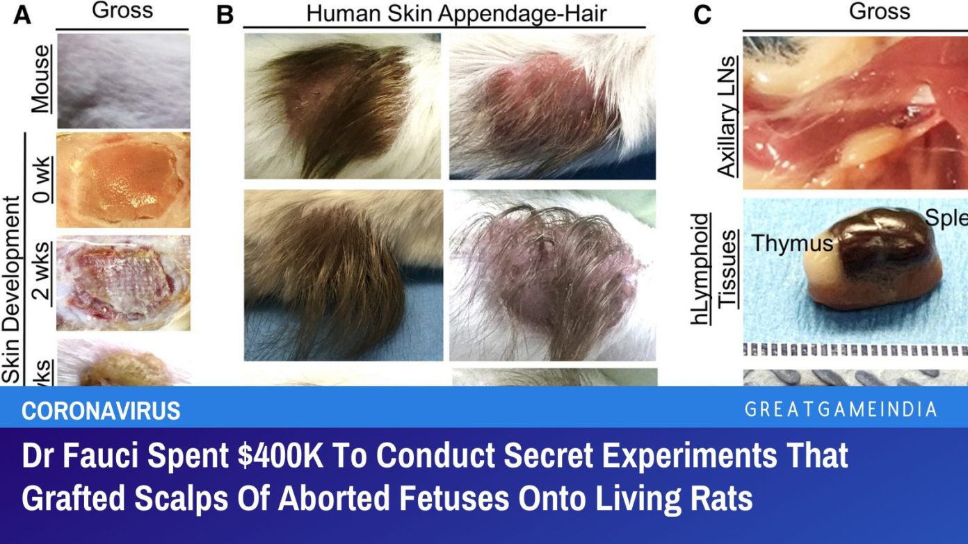 dr fauci spent $400k to conduct secret experiments transplanting scalps of aborted fetuses onto living rats