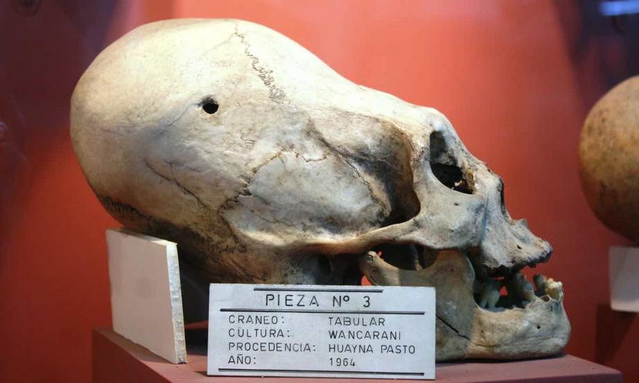 paracas skulls 1
