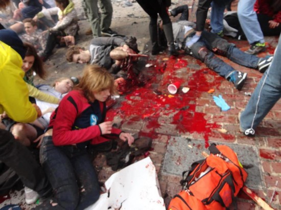 Fake Boston Marathon Bombing actor scene with fake blood