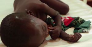 Niger_child with rotavirus infection_(archives)