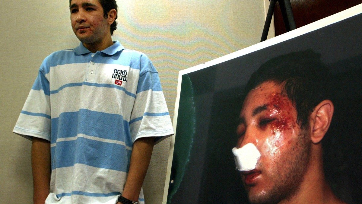 Rashid Alam, a 18-year-old Muslim pauses next to a photo taken following his attack, at a news conference Wednesday, April 23, 2003, at the Council on American-Islamic Relations offices in Anaheim, Calif. (AP Photo/Damian Dovarganes)