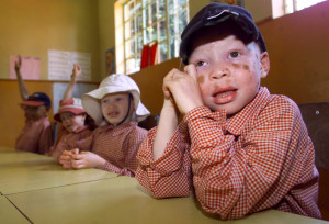 Children with albinism often have poor eyesight, so classroom seating plans are important. Courtesy Antony Njuguna/Reuters 