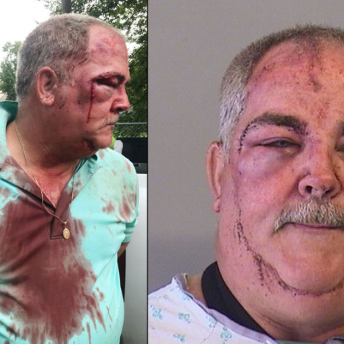 Man Beaten by Police During Arrest Says he Never Assaulted Officers – He Just Wanted to Get to His Property