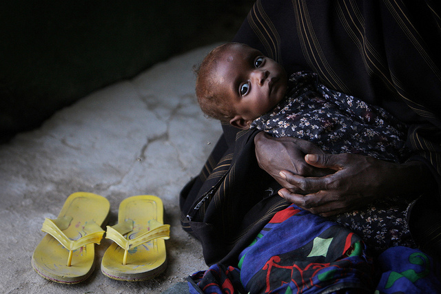 Somalia Starvation eb3cd