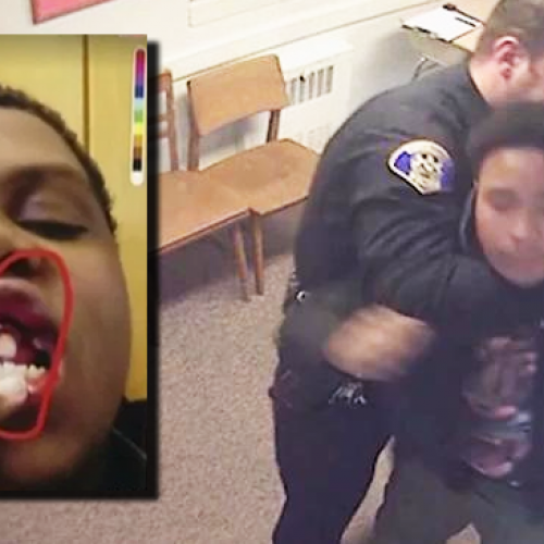 Cop Chokes 14yo Child at School, Knocks His Teeth Out