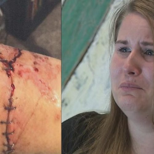 [WATCH] Woman Bitten by Police Canine Sues Newark Police Department