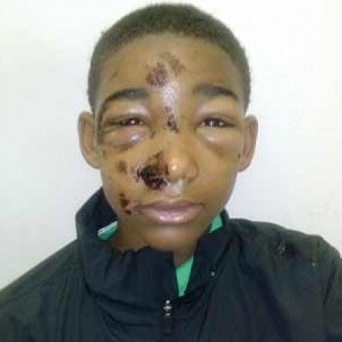 Cops Beat 14-yr-old Boy, Claims Mother  — Cops Deny It