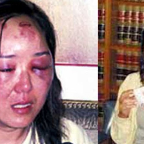 Chinese Tourist Awarded $461,000 for Brutal Beating She Received at Hands of US Border Agent