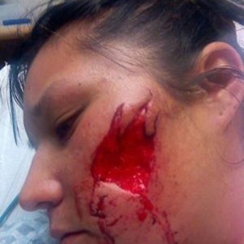 K9 Cop Stops Woman for “Speeding,” Attack Dog Rips Flesh Off Her Face