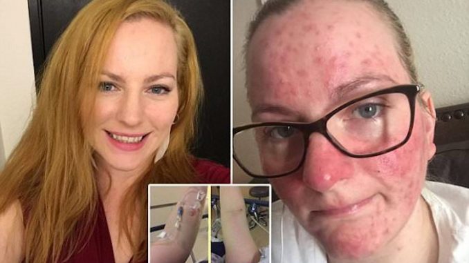 Flu jab left British mother with multiple sclerosis