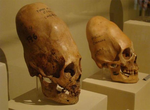 Paracas skulls, found on the south coast of Peru. (CC BY-SA 4.0)