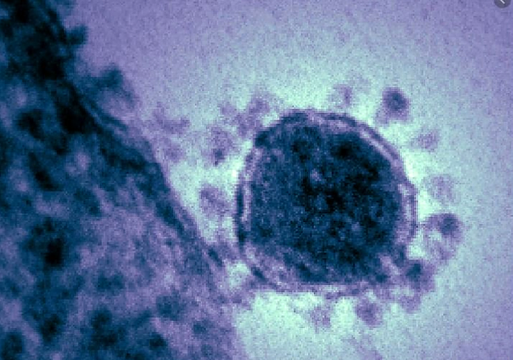 In virology, influenza A virus subtype H1N1 (A/H1N1) is the subtype of Influenza A virus that was the most common cause of human influenza (flu) in 2009, and is associated with the 1918 flu pandemic. It is an orthomyxovirus that contains the glycoproteins haemagglutinin and neuraminidase. For this reason, they are described as H1N1, H1N2 etc. depending on the type of H or N antigens they express with metabolic synergy. Haemagglutinin causes red blood cells to clump together and binds the virus to the infected cell. Neuraminidase is a type of glycoside hydrolase enzyme which helps to move the virus particles through the infected cell and assist in budding from the host cel.