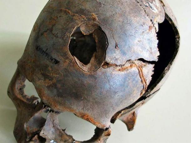 One of the skulls found at Europe’s oldest massacre site in Germany. Note how the skull has been smashed in, likely with a deadly wooden club. (State Office for Culture and Preservation Meckleburg-Vorpommern)