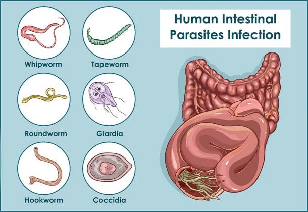 These are just a few of the parasitic worms and other life forms that can live in our gut bacteria and harm us, and this was true a thousand years ago and today. (corbacserdar / Adobe Stock)