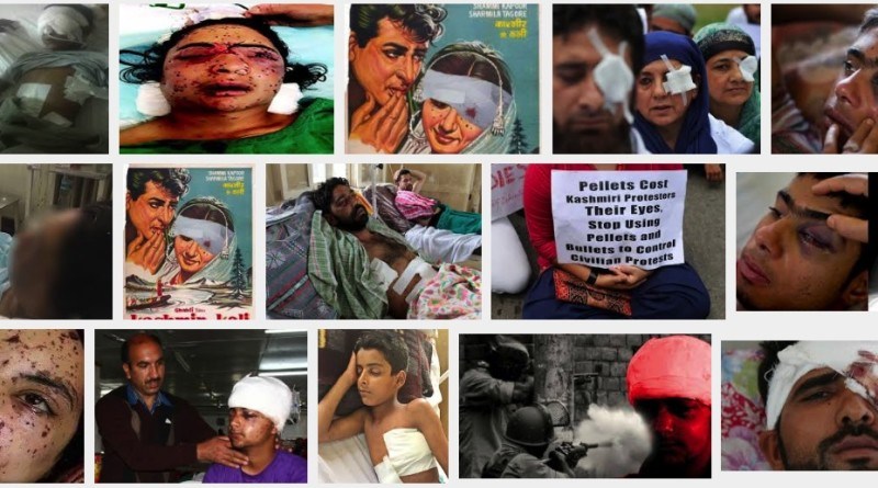 Kashmiri children injured by Indian forces firing pellets in Kashmir