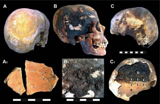 Red and black mineral incrustations detected in Vesuvius victims' skulls. (Image: © 2018 Pierpaolo Petrone et al )