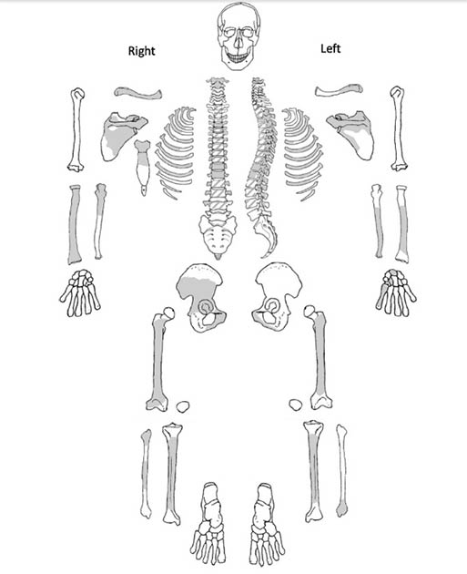 The skeletal inventory of the remains discovered dating from Bronze Age China. The shaded areas show the present skeletal remains found at the site. (Jenna Dittmar / Science Direct)