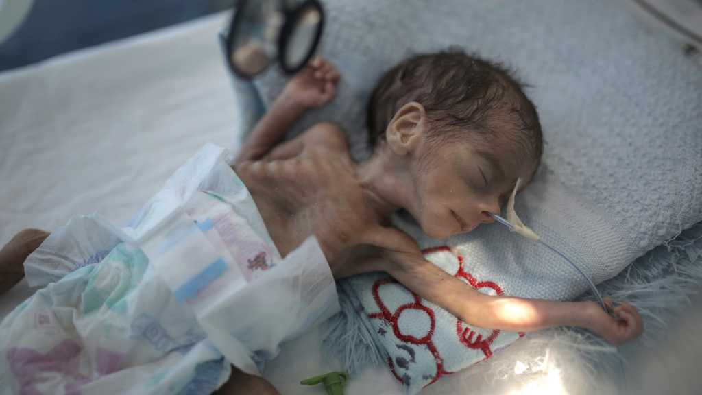 Malnourished Children Starve as Pandemic Worsens Yemen’s Humanitarian Crisis