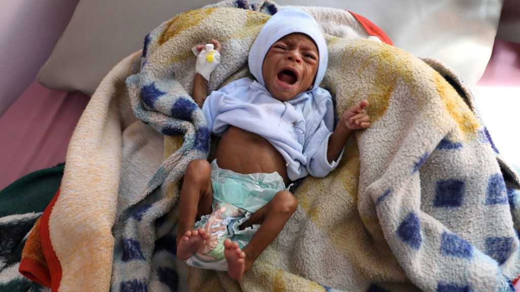 Millions of Children’s Lives at High Risk as Yemen Inches Towards Famine - UNICEF
