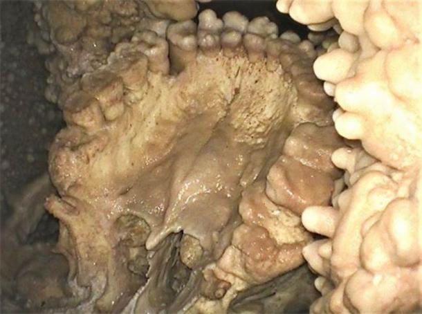 Forensic evidence obtained from Altamura Man’s mouth showed that he had dental calculus and suffered from gum disease. (Sapienza Universita de Roma)