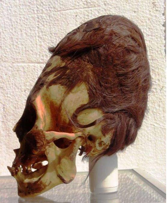 A Paracas skull with its red hair. (Brien Foerster)