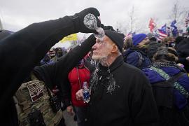 A demonstrator has his eyes flushed with water after confronting police at the Capitol in Washington, USA. January 6, 2021