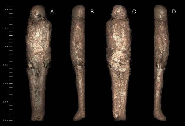 3D-rendered CT images of the mummified person, showing the mud carapace which surrounded the body – demonstrating a previously unknown mortuary practice. (Sowada et al. Courtesy Chau Chak Wing Museum and Macquarie Medical Imaging/ PLOS ONE/CC BY 4.0)