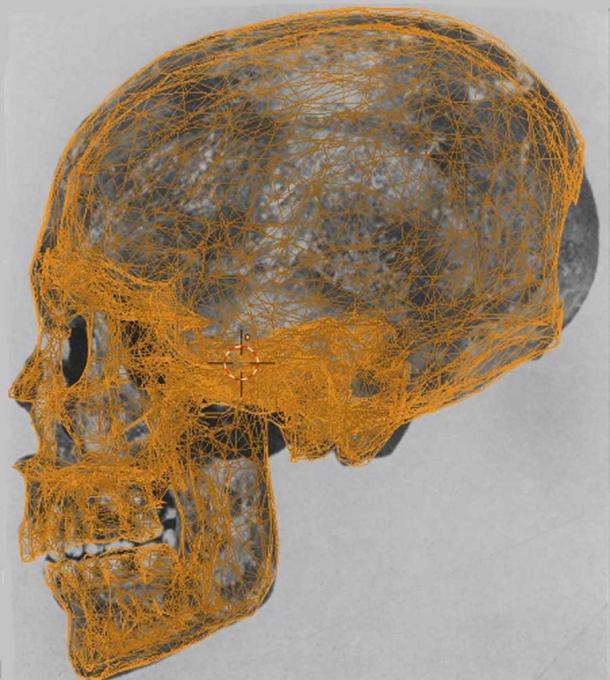 Mummy KV55’s skull with data points used in the facial reconstruction. (FAPAB Research Center)
