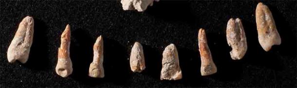 The jade and pyrite inlayed teeth of the El Palmar diplomat, Ajpach’ Waal. (Kenichiro Tsukamoto / University of California, Riverside)