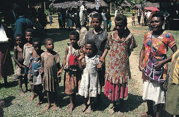 Papua New Guineans in 2005. A typical scene in a village that has lost many of its young men to the towns as rural-urban migrants. The population structure of such villages is quite unbalanced. (Stephen Codrington/CC BY 2.5)