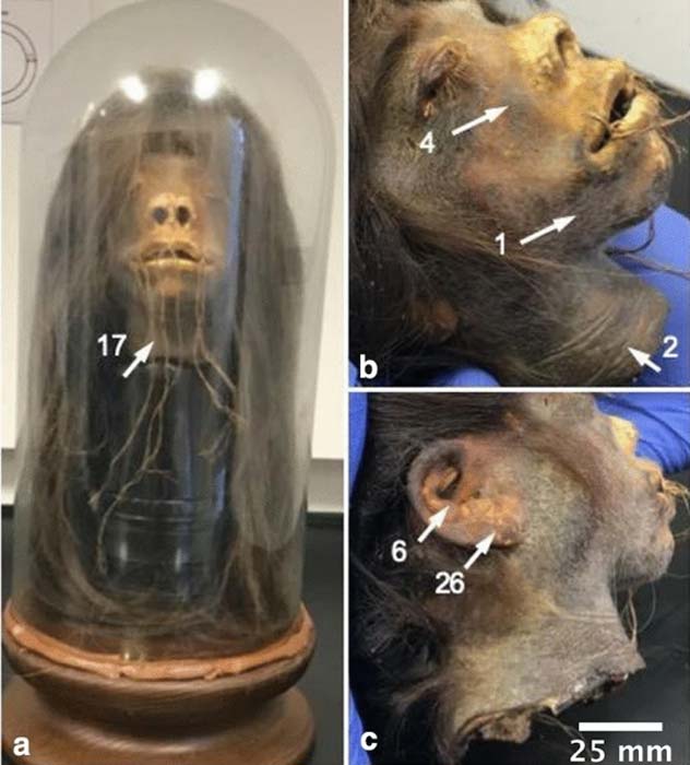 The shrunken head from Ecuador that got to go home again. Tsantsa of probable Ecuadorian origin as found in Mercer University’s cultural museum collection in 2018. a) The tsantsa was preserved resting under a plastic bell jar secured to a wooden base with adhesive. b) Skin characteristics of the tsantsa: darkened skin color, leathery skin texture at neck opening, and smooth cheeks. c) Anatomy of the tsantsa ears were well preserved and no evidence of ear piercing. Numbers correspond to the Tsantsa Authentication Checklist in Table 1 of the research paper, published by Heritage Science. (Heritage Science)