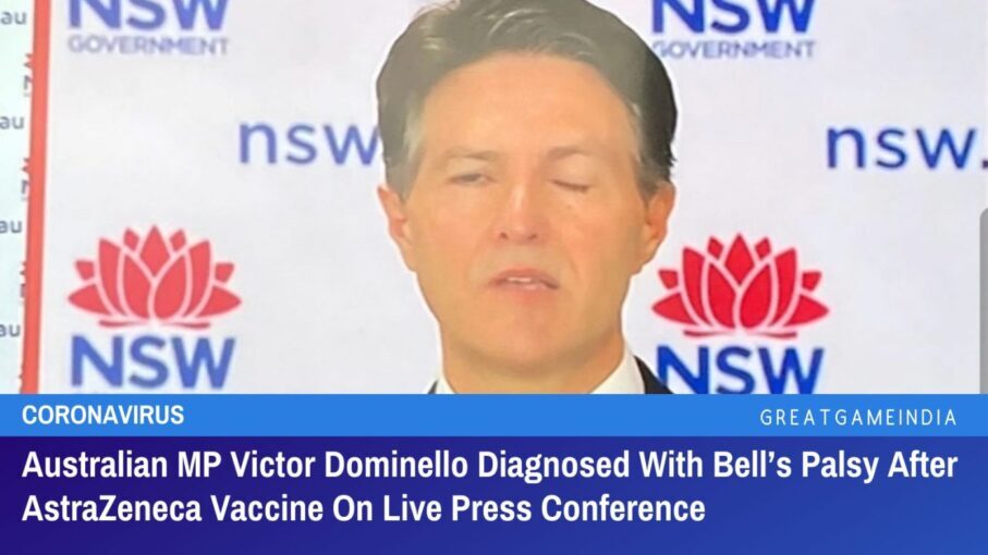 australian mp diagnosed with bell’s palsy after astrazeneca vaccine on live tv