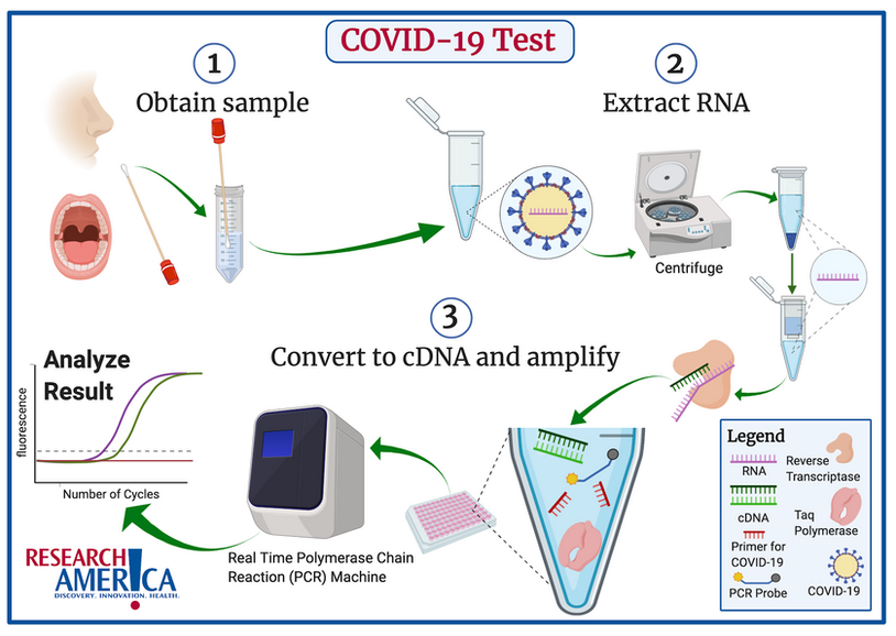 The COVID-19 test starts by taking a sample from the patient’s nose or mouth. Samples are taken from these locations because they are easily accessible and are known to contain the virus. The next step is to isolate RNA (pink notched line) from the patient sample. RNA is isolated because COVID-19 is an RNA based virus. RNA extraction is a common laboratory procedure that can be performed with commercially available kits containing the appropriate “recipe” to separate RNA from the rest of the components in the sample. A centrifuge is used to separate materials by their densities and plays an important role in the RNA extraction phase. Once the RNA is extracted, it is converted into complementary DNA (cDNA) (green notched lines) via an enzyme called reverse transcriptase (peach-colored protein). The RNA must be converted into cDNA because the final step of the test can only be performed on DNA. The cDNA is now combined with primers specific for COVID-19 (red notched line), a special enzyme called Taq polymerase (pink protein), and a special fluorescent probe (blue line with yellow and gray endings). The design of these primers enables us to specifically test for COVID-19 and they rely upon information from the sequence of the COVID-19 genome. Taq polymerase and the fluorescent probe are standard components for this test (the rapid test uses the same principle but a colorimetric rather than fluorescent probe). All of these components are loaded into a plate and run in a Real Time Polymerase Chain Reaction (PCR) machine. Real Time PCR is a standard laboratory technique that amplifies a region of cDNA between the two primers. Since these primers are specific to COVID-19, the Real Time PCR test will not amplify any cDNA if the original patient sample did not contain COVID-19 RNA. If the patient sample did contain COVID-19 RNA, the amplification of the cDNA will eventually reach a level that is detected by the Real Time PCR machine using the fluorescent probe. The data is then exported from the Real Time PCR machine onto a computer and analyzed. If the patient sample shows a level of COVID-19 RNA which is above the negative sample threshold and all of the controls produce the expected results, the patient tests positive for COVID-19.