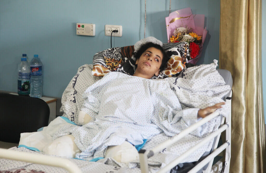 Rahaf Salman, 11, receives treatment at a hospital in the northern Gaza Strip on August 9, 2022. Salman lost both her feet and her right hand during the latest Israeli aggression on the Gaza Strip. (Photo: Omar Ashtawy/ APA Images)